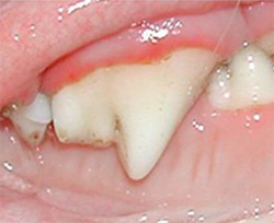 The first signs of dental disease